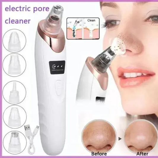Blackhead Remover Vacuum – Deep Pore Cleaner for Smooth Skin