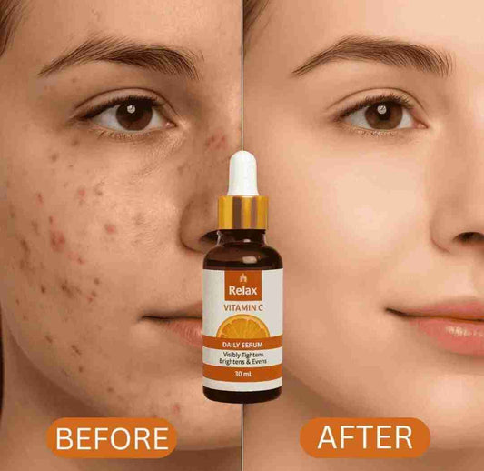 Relax Vitamin C Daily Serum - 30ml | Visibly Brightens, Evens Skin Tone