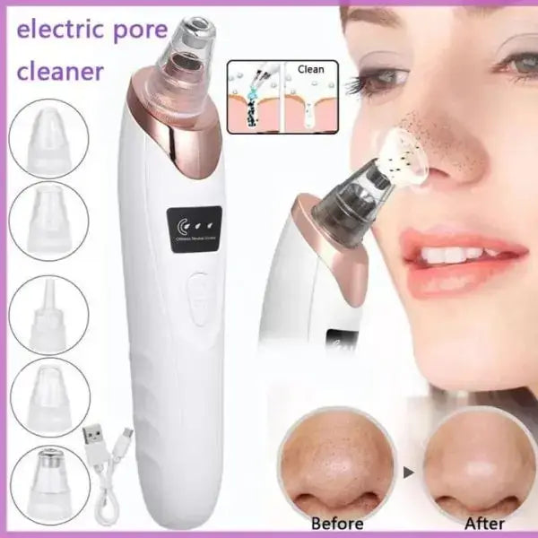 Blackhead Remover Vacuum – Deep Pore Cleaner for Smooth Skin